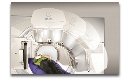 Elekta Infinity Treatment picture