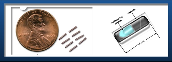 Seed Implant Picture &amp; Diagram